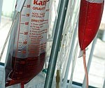 Ielu darbinieki palīdzēs risināt HIV/AIDS problēmu