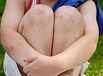 Noticis dzimumnoziegums. Upuris – bērns