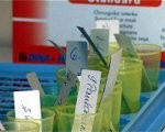 Tuberkulozes slimnieku skaits palielinās