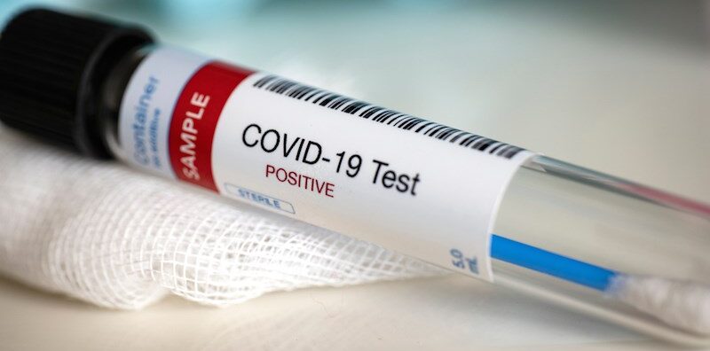 Otrdien Latvijā reģistrēti 983 jauni Covid-19 gadījumi, 17 sasirgušie miruši