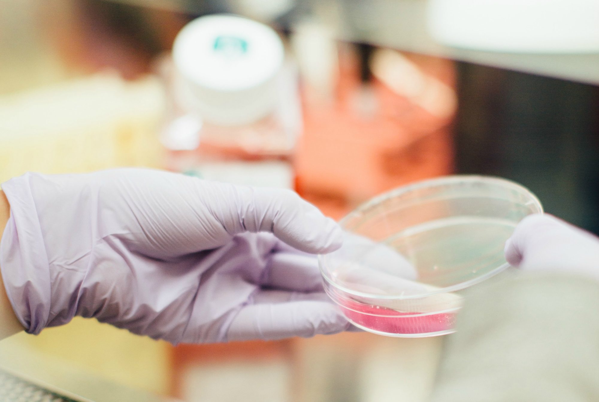 Aicina HIV pozitīvas personas izmantot bezmaksas pakalpojumus