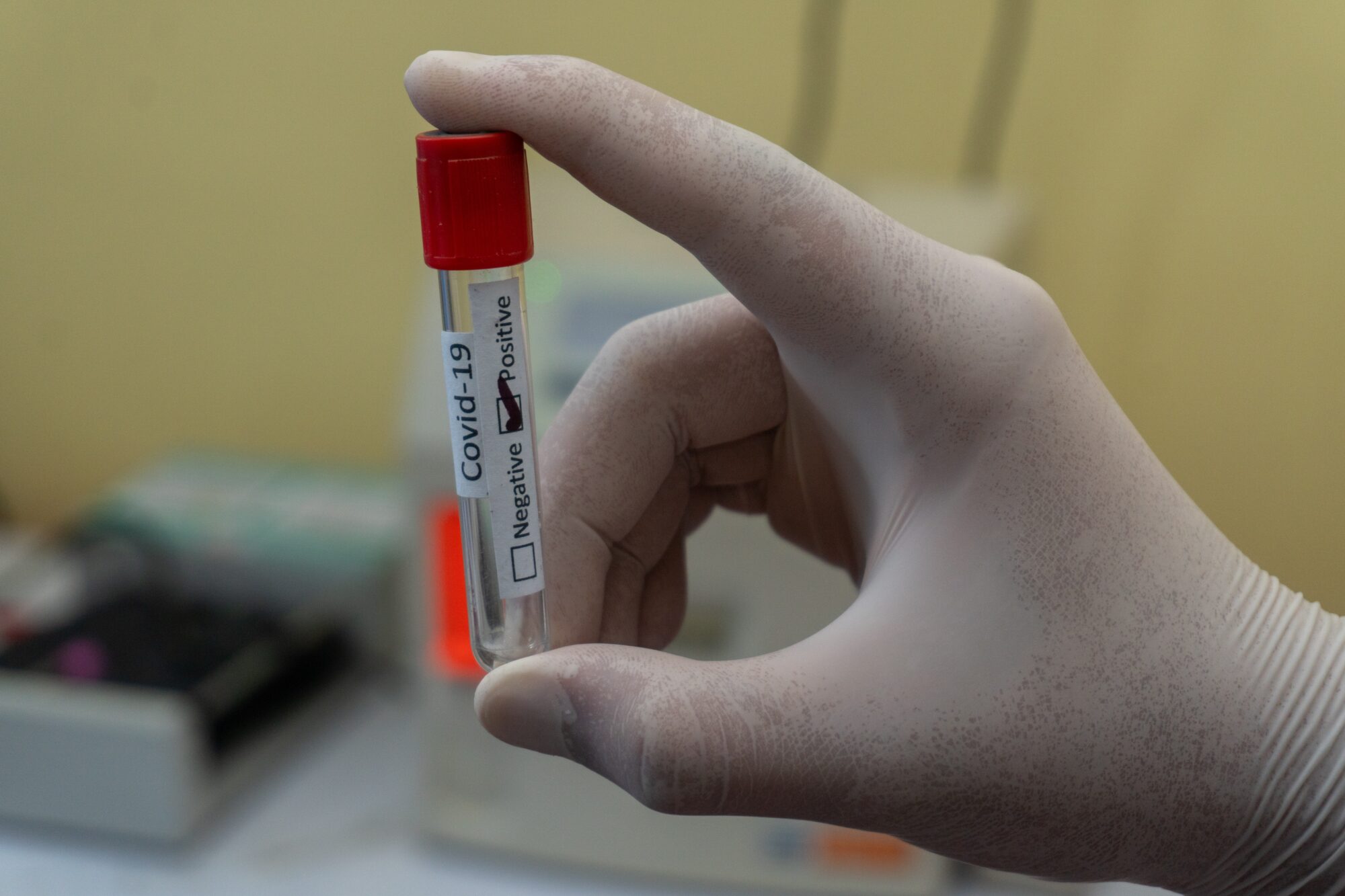 Svētdien Latvijā atklāti 422 Covid-19 gadījumi un miruši trīs saslimušie