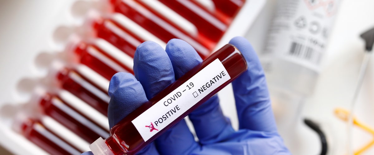 Latvijā augstākais saslimstības līmenis ar Covid-19 ir Kuldīgā un Liepājā￼