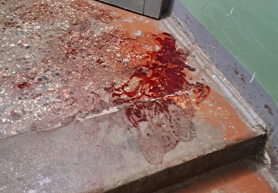 Asiņainas pēdas Daugavas ielas kāpņu telpā
