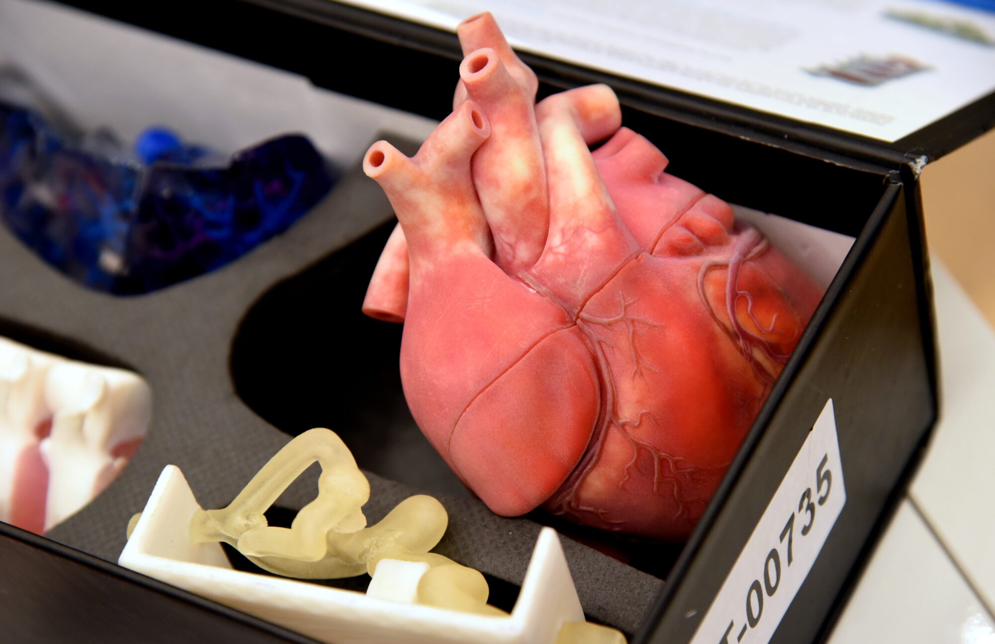 Kardiologi aicina pievērst uzmanību paaugstinātam lipoproteīna līmenim