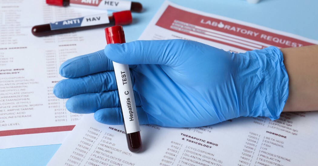 Pārbaudi savu HIV, B un C hepatīta statusu