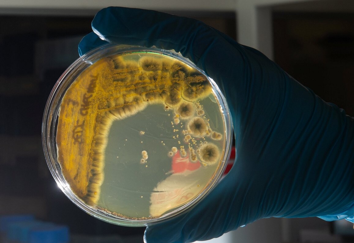SPKC konstatējis vēl trīs E.coli saslimšanas gadījumus