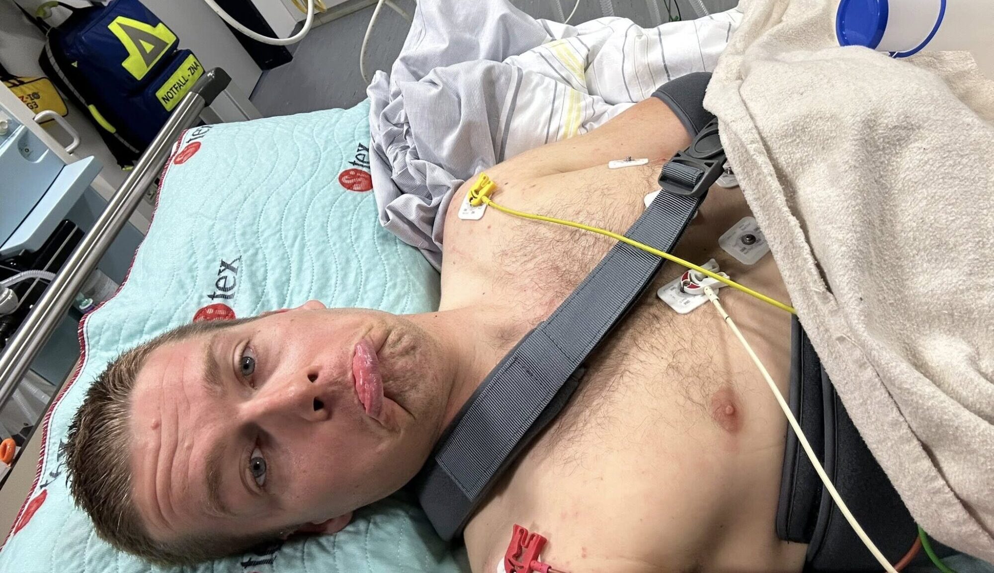 Jonasam pēc kritiena Vācijas “Grand Prix” lauzts atslēgas kauls un lāpstiņa