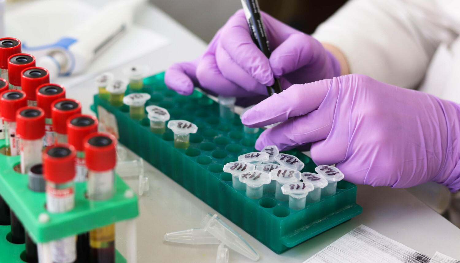 197 iedzīvotājiem atklāts pozitīvs C hepatīta tests