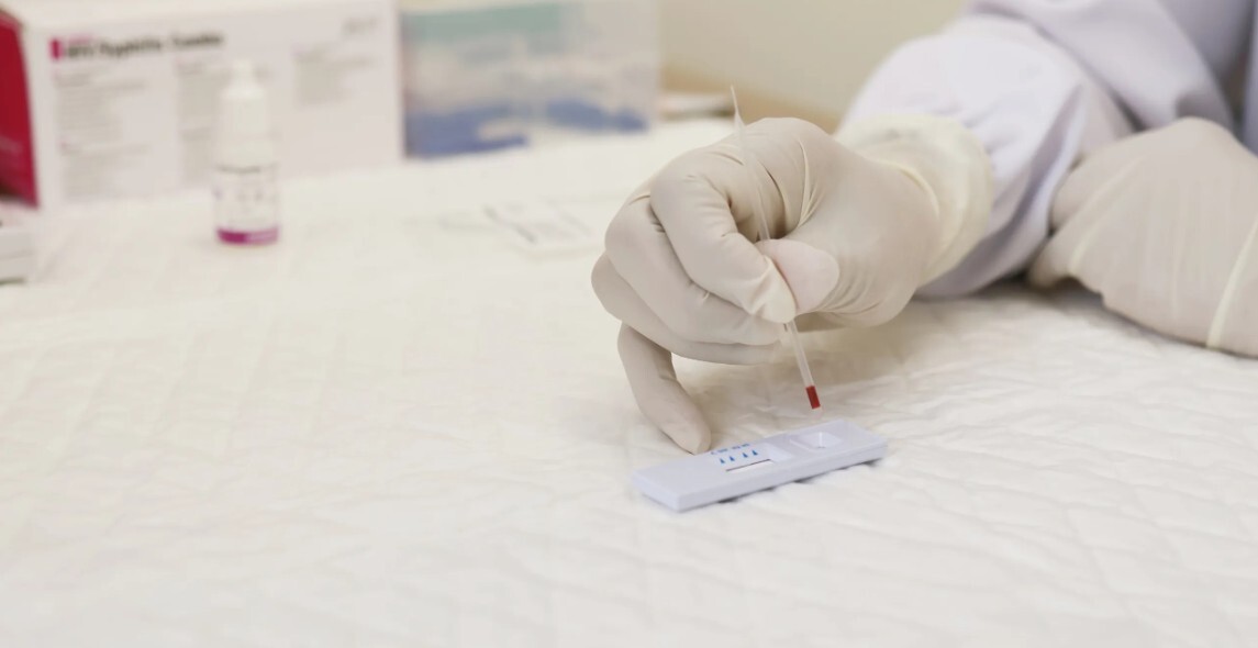 Aicina bez maksas veikt HIV, B un C hepatīta, kā arī sifilisa eksprestestus visā Latvijā