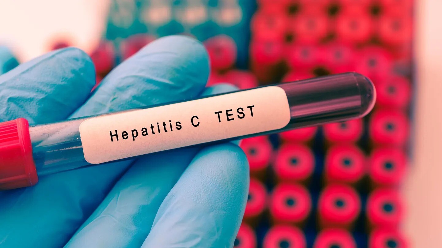 Austrumu slimnīcā varēs bez maksas veikt C hepatīta un HIV testus