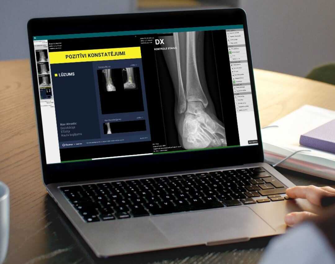 Kurzeme: Rentgena diagnostikā izmanto mākslīgo intelektu