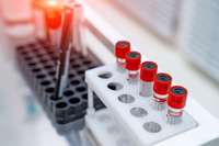 “Centrālā laboratorija” nedēļu veiks C hepatīta un HIV bezmaksas testus